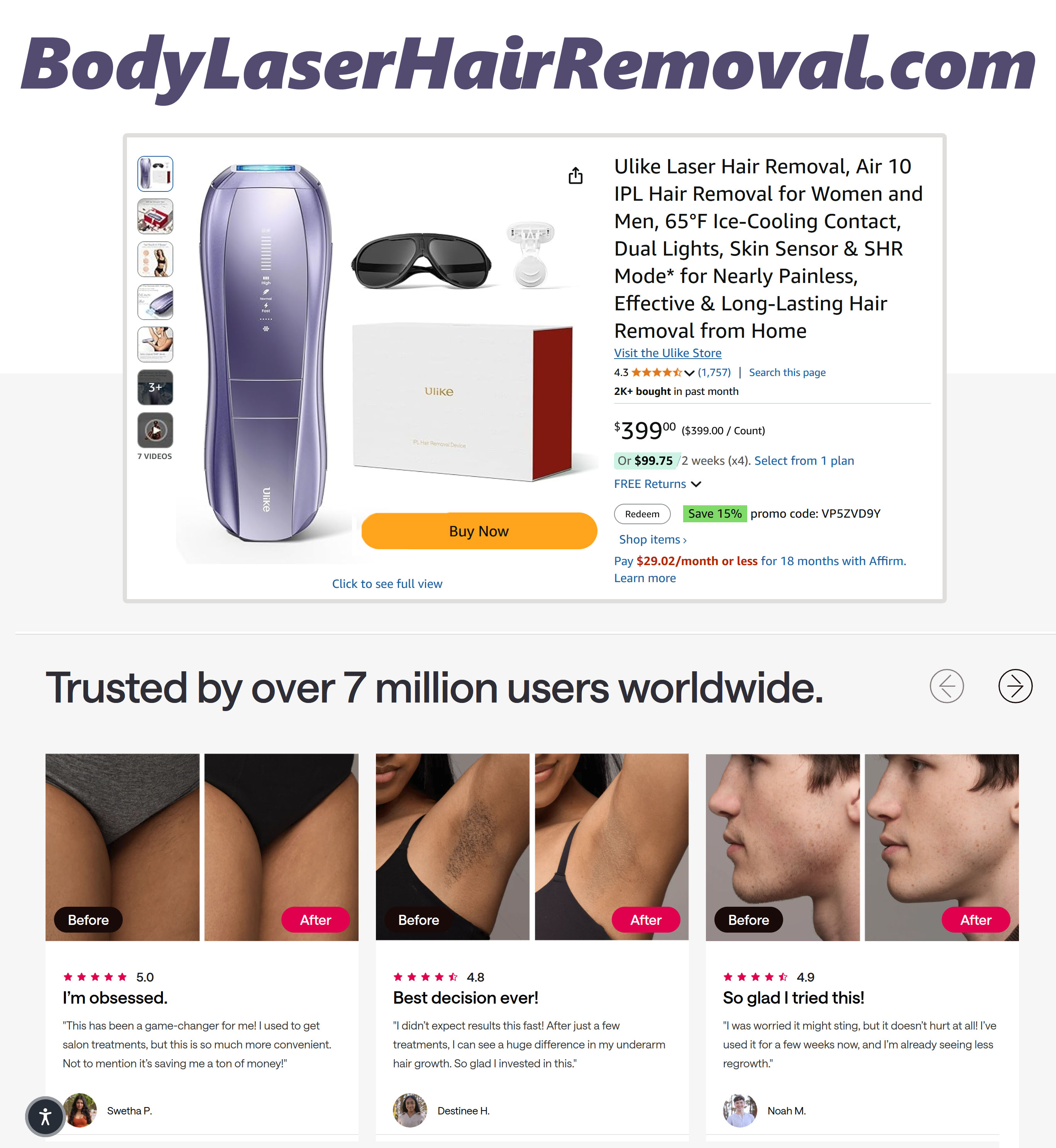 body laser hair removal